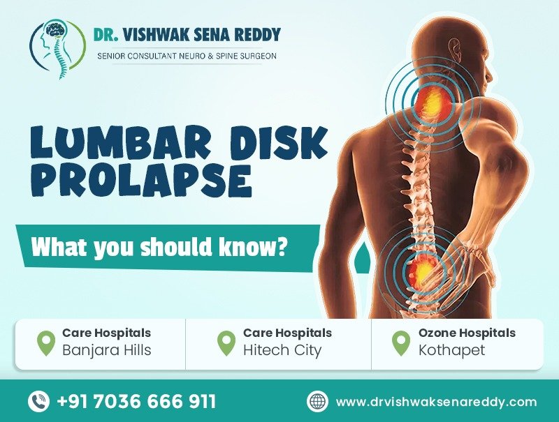 Lumbar Disk Prolapse: What You Should Know?